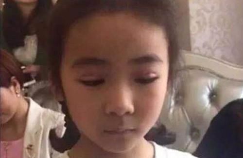 亲妈为让女儿更漂亮,带5岁的女儿割双眼皮,网友不配为人母