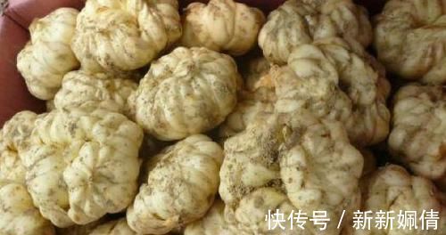 排尿|血糖高不高，“一泡尿”就知道！排尿出现3异常，或是糖尿病来了