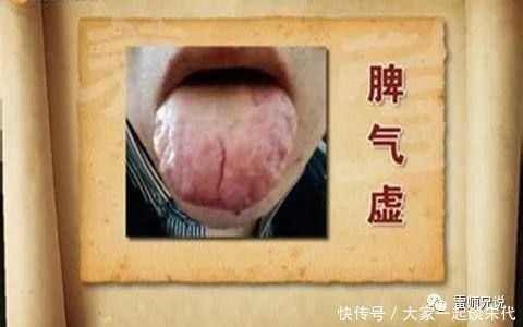 人虛生百病,氣虛、肺虛、脾虛,4味中藥補(bǔ)虛不上火,身體更健康