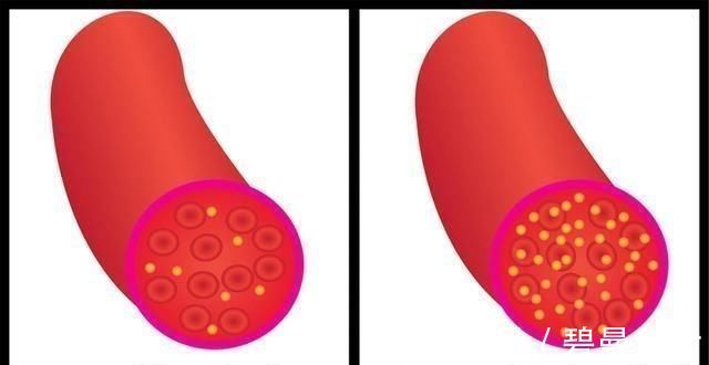 红叶|内科医生热水里撒一把,连喝1月,血糖降了,跟糖尿病“再见”