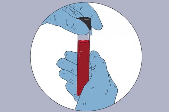 胰岛素|糖尿病患者，为何要检测胰岛素水平？什么时候该注射胰岛素？