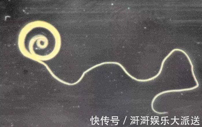 无花果|这4种常见的水果,含有大量寄生虫,虽然有营养,但孩子不能多吃