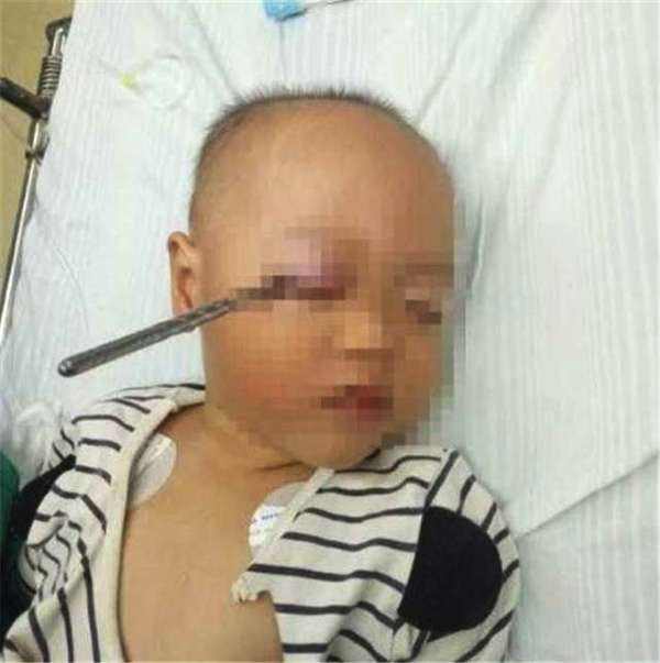 宝宝|粗心婆婆照顾孙子吃饭,却使得两岁宝宝右眼永远失去光明