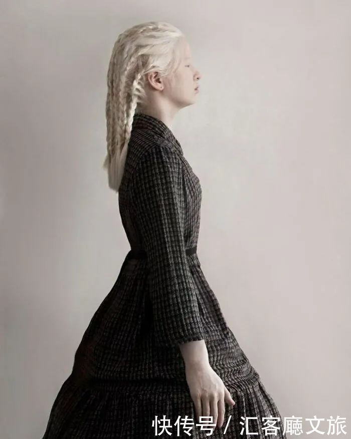 逆袭|因“全身雪白”被遗弃的中国女孩,逆袭成超模的故事让人泪目