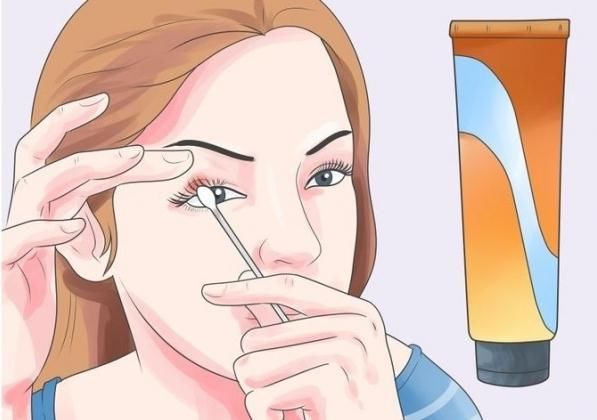 麦粒肿|眼皮上的这个红色“小疹子”，千万别大意！