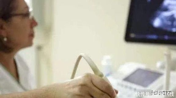 胎心|孕期准妈妈做产检,出现这些信号,是聪明的“男宝宝”