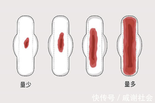 中间量|为何有的女性月经，三天就没了，有人七天还没走？有什么不同？