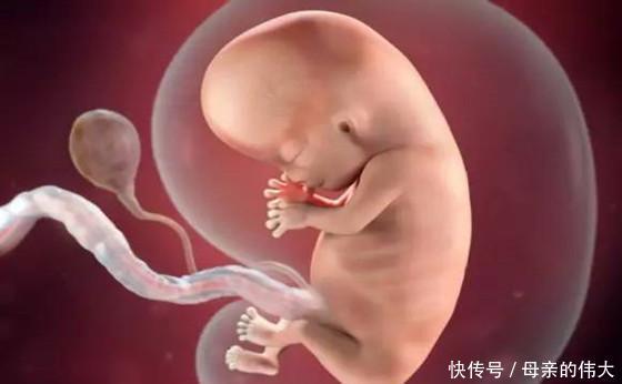 怀孕|一次产检没落却生下畸形儿!怀孕注意这些事,和产检一样重要!