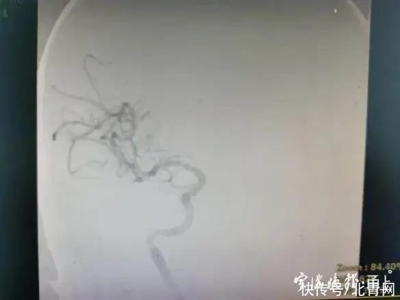 吴大伯|紧急提醒！宁波有医院一连收治16例！医生：最近这件事千万别忘了做……