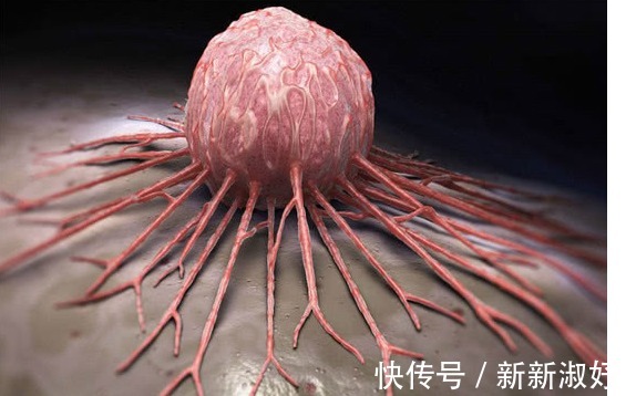 癌细胞|有没有癌，“腿”知道，若有以下3种异常，也许是癌细胞来访