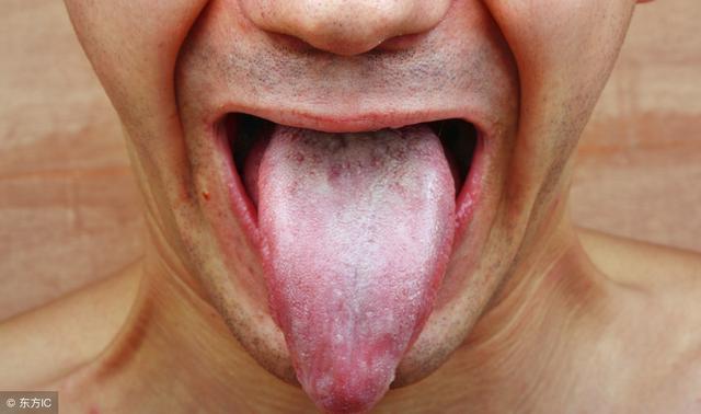 水蜜丸|医生如果你有八个肾虚现象，对症试试中药有效。