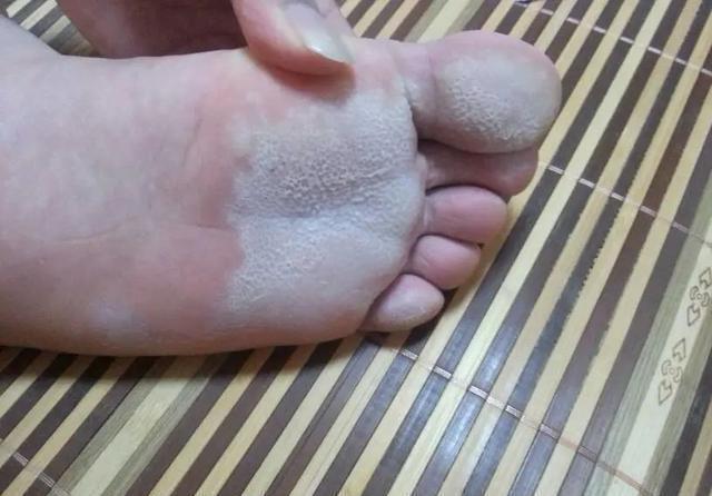 胃火|常吃南瓜给身体带来的3个好处,但是这3类人不建议你吃南瓜