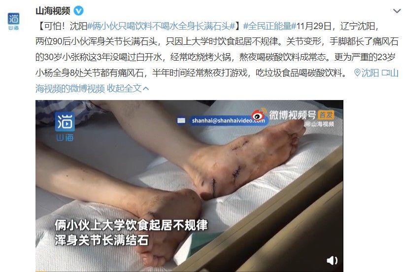 习惯|可怕！男子全身布满“石头 这些习惯很多人都有