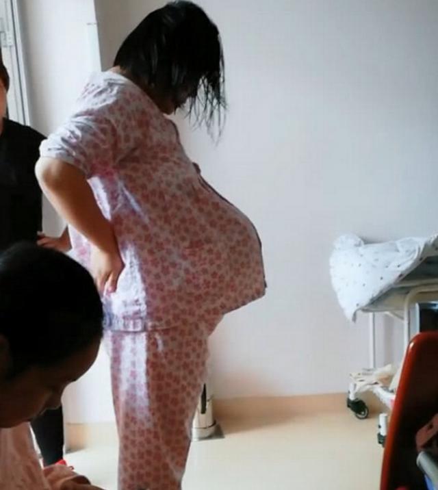 肚子|“悬浮肚”孕妇网上爆红,头一次见这种肚型,网友:是双胞胎?