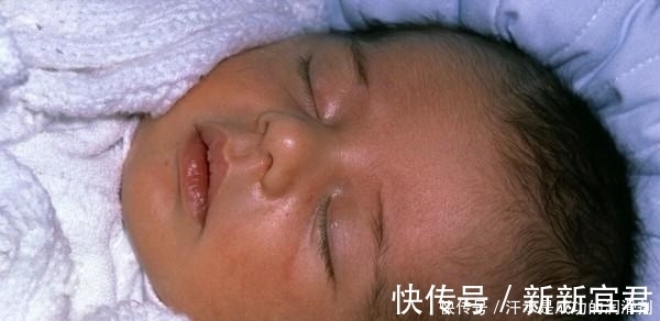 胆红素|不想宝宝出生后被黄疸“找上门”，孕期孕妈坚持“三不做”很关键