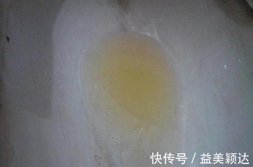 张力|尿中为什么有泡沫?泡沫尿就一定代表有肾脏病吗?医生告诉你