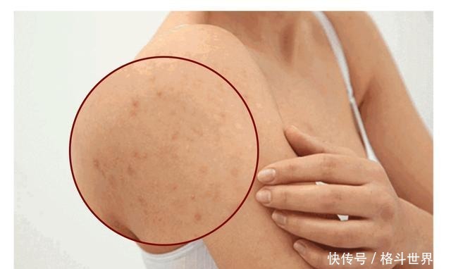 女孩|那些坚持涂身体乳的女孩,皮肤都怎么样了