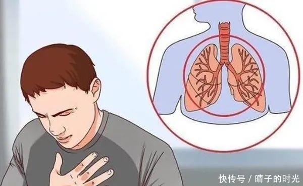 肺癌成为癌症中的第一杀手,你了解如何科学防癌吗?