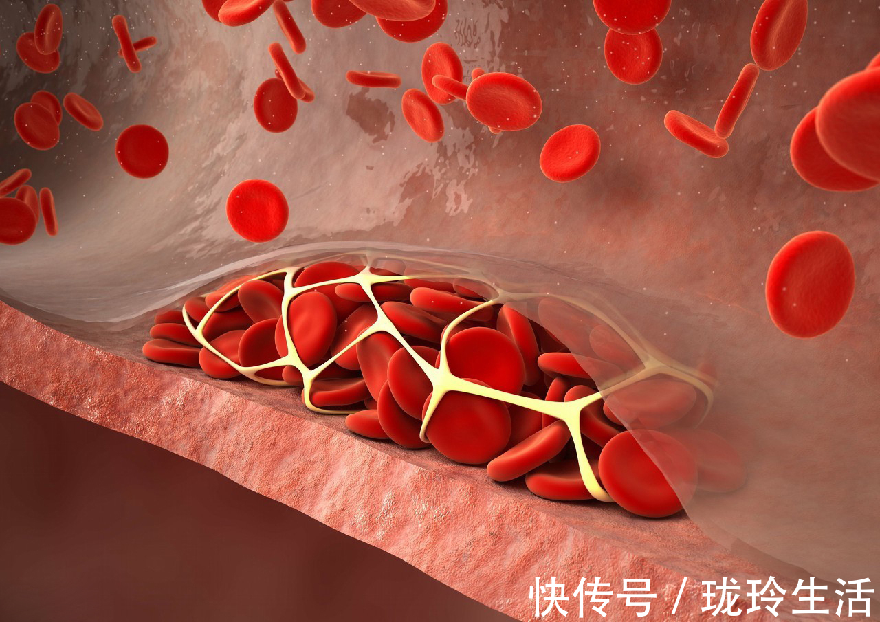 清道夫|血管“清道夫”被找到了，每天吃一点，血管不堵不硬，远离血栓！