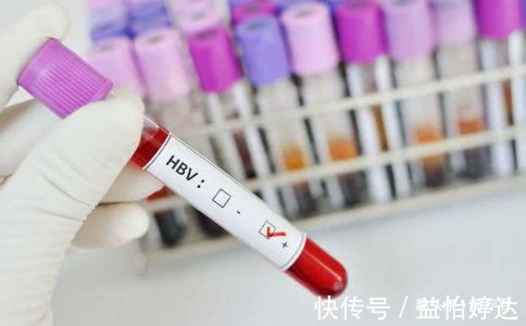 肝脏|10年间，4兄弟3人肝癌离世，医生叹息这种结局是完全可以避免的