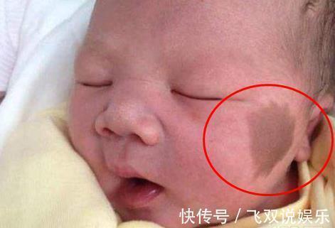 孕妈|怀孕后,几件事孕妈最好别做,容易在宝宝身上留下“胎记”!