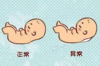 唐氏筛查|第一次胎儿排畸做什么关于NT筛查,孕妇一定要懂