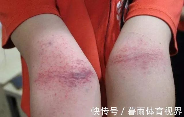 尺泽穴|人体自带4个长寿窝,每天只要5分钟,拍一拍,心肝脾肺肾都好了!