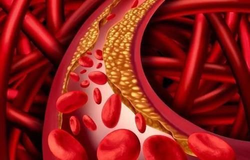 血脂|每天喝牛奶，对高血脂有什么影响？血脂高的人，医生建议了解下