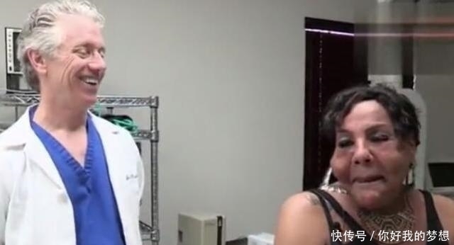 女子花2万元整容,整容失败变成“水泥脸”,看完你还想整容吗?