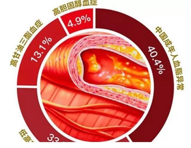 胆固醇|不用药,怎么降低血脂?