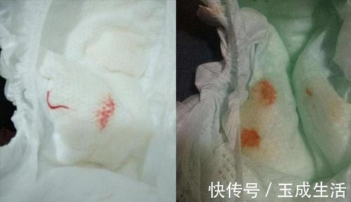 现象|“妹妹流血啦,妈妈快来”,面对意外,哥哥的反应让医生竖起拇指