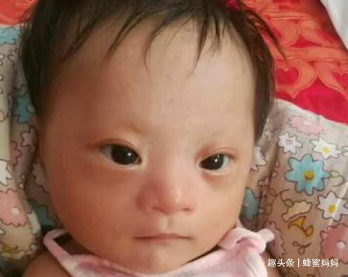 唐筛|“唐氏宝宝”越来越多,诱因多半源于父母,这3种孕妈难逃噩运