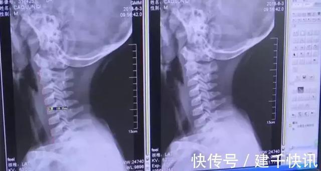 孩子|一年来男孩一直做一件事,妈妈发现后立刻送医,医生却说来晚了