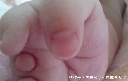 孕妇连生三胎都是畸形儿,医生检查完后,大骂这家人无知!