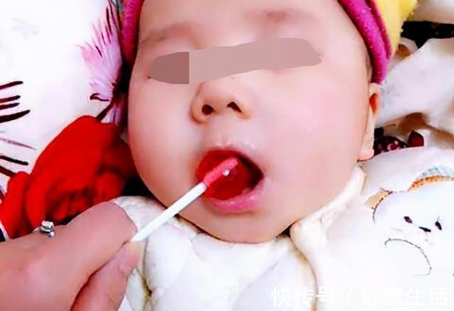 女婴|五个月女婴双肾长满结石,只因刚出生三天,父母就开始做这件事