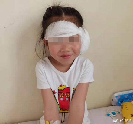 手术|5岁女娃耳后反复鼓脓包 祸根竟是“它”