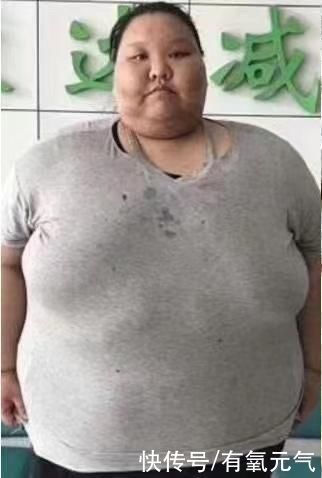 体重|400斤姑娘把床压塌,胖到只能睡地板,减肥1年后亲妈也差点认不出