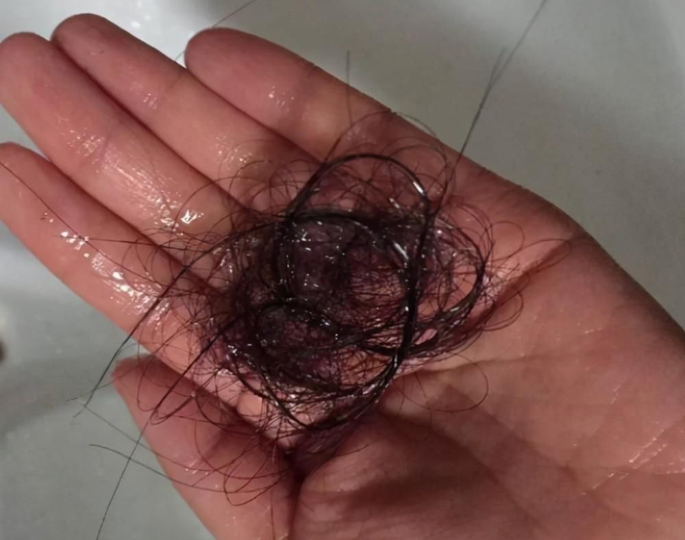 洗发水|多久洗一次头胎是最正常的呢?头发需要“天天洗”吗?