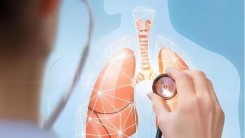 肺结节|海鲜是肺结节的“发物”?医生:有肺结节的人,少吃这2种食物才是关键