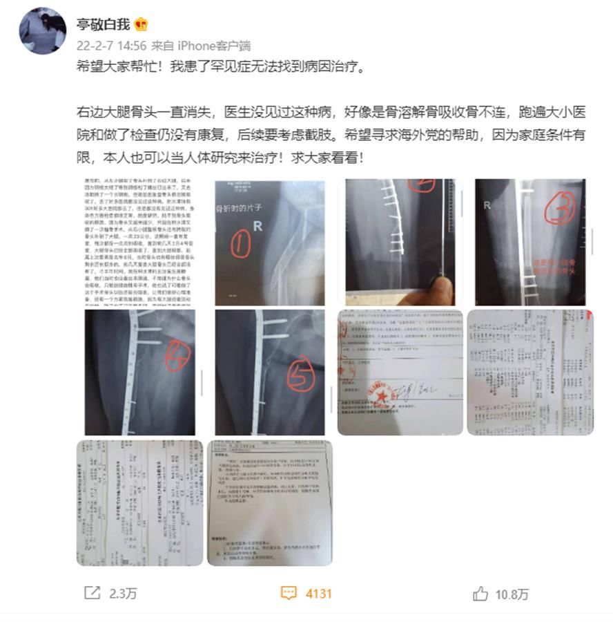 病因|“右大腿骨折后骨头一直消失”，女生自述患罕见病多年无法找到病因