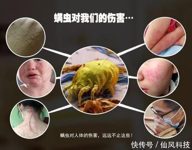 螨虫|90的人都在陪螨虫睡觉螨虫最怕3种东西,好好利用,螨虫跑光光