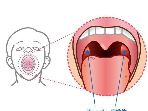 肠胃不好，多吃水果！胃热、胃寒的人，吃什么水果养胃？早知早好