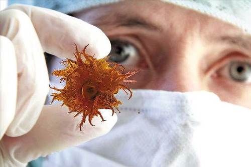 肿块|结节是肿瘤吗?癌变的几率有多大?医生带您了解身上的凸起、肿块