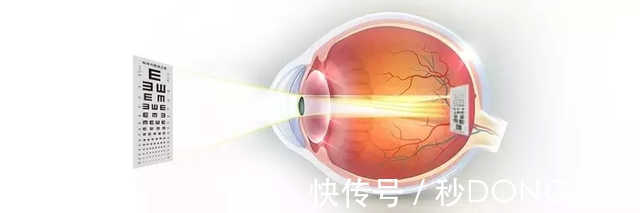 家长们|保护视力，拒绝近视！家长们看这里！