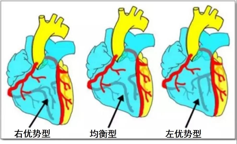 左心室|【健哥说心脏】你了解冠状动脉吗？