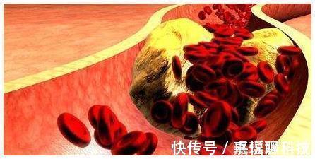 芸豆|它是“天然阿司匹林”,经常吃一点,可能“血栓”会悄悄溜走