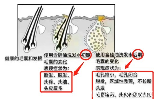 氨基酸|孕妈谨慎！被医生拉入黑名单的洗发水！孕妈该选宝藏级洗护看这里