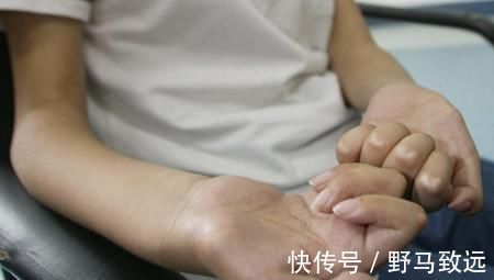 类风湿|类风湿患者:不补钙,当心再也站不起来