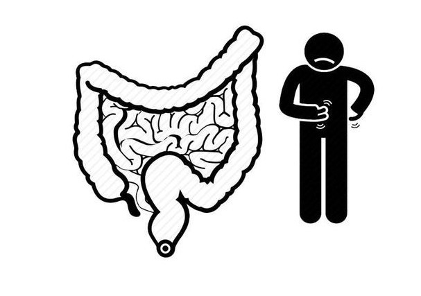 单发性|常见的肠道息肉类型，离不开这6种，但每一种都让人“不省心”