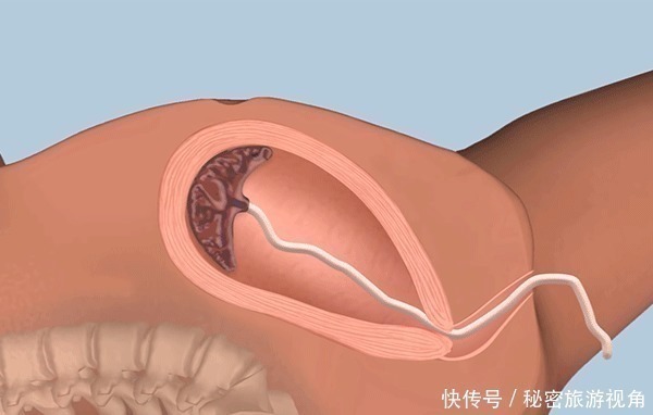 胎盘|生完宝宝男医生又来一个“回手掏”,宝妈气急质问,医生 为你好